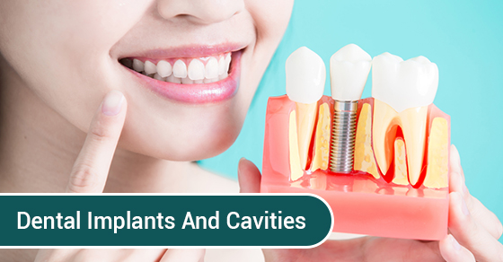 can dental implants get cavities