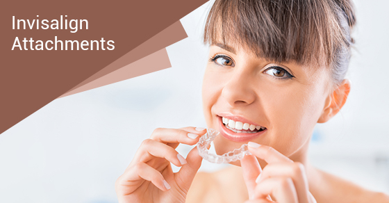 invisalign attachments at willow dental