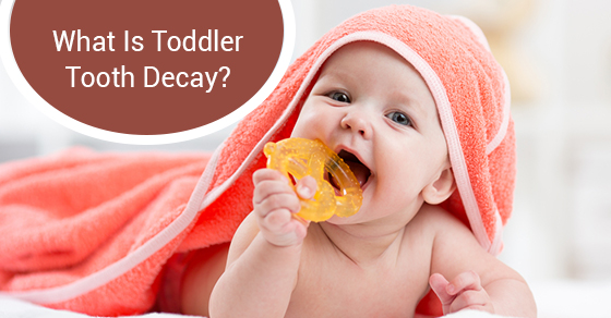 toddler tooth decay