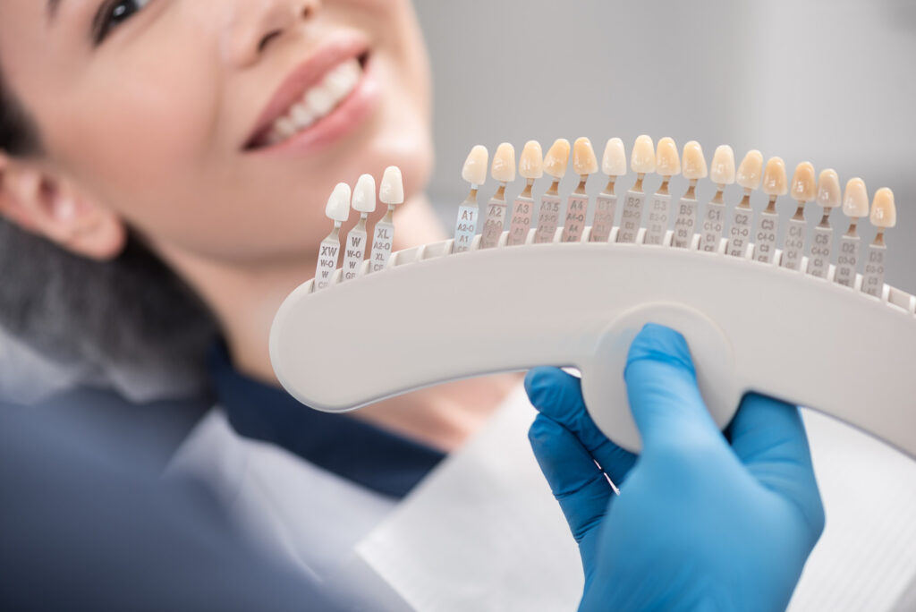 Dental Veneers vs Dental Crowns: What’s the Difference?