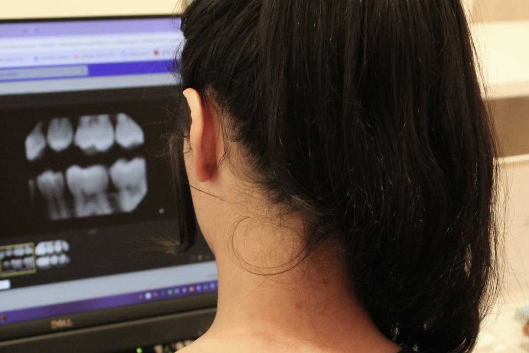 General dentistry at Willow Dental